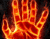 سوزاندن دست
