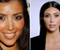 Előtt és után Kim Kardashian